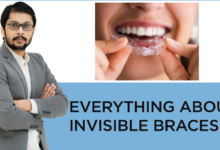 Understanding the Benefits of Invisible Braces