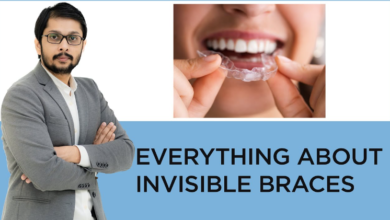 Understanding the Benefits of Invisible Braces