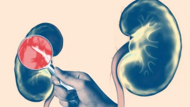 Beyond the Basics Uncovering Lesser-Known Effects of Kidney Disease