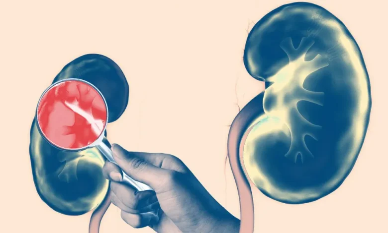 Beyond the Basics Uncovering Lesser-Known Effects of Kidney Disease