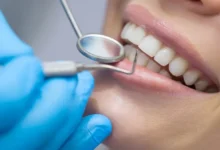 Celebrity Dentists Don’t Need To Advertise