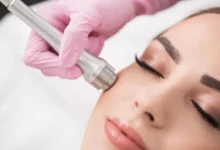 Exploring the Evolution and Impact of Advanced Devices in Modern Dermatology